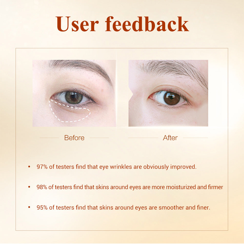 Rosavie Luxury Hydrogel Eye Patches – Dark Circles, Puffy Eyes & Wrinkle Care