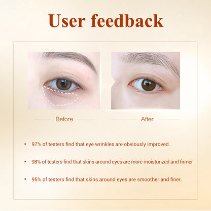 Rosavie Luxury Hydrogel Eye Patches – Dark Circles, Puffy Eyes & Wrinkle Care
