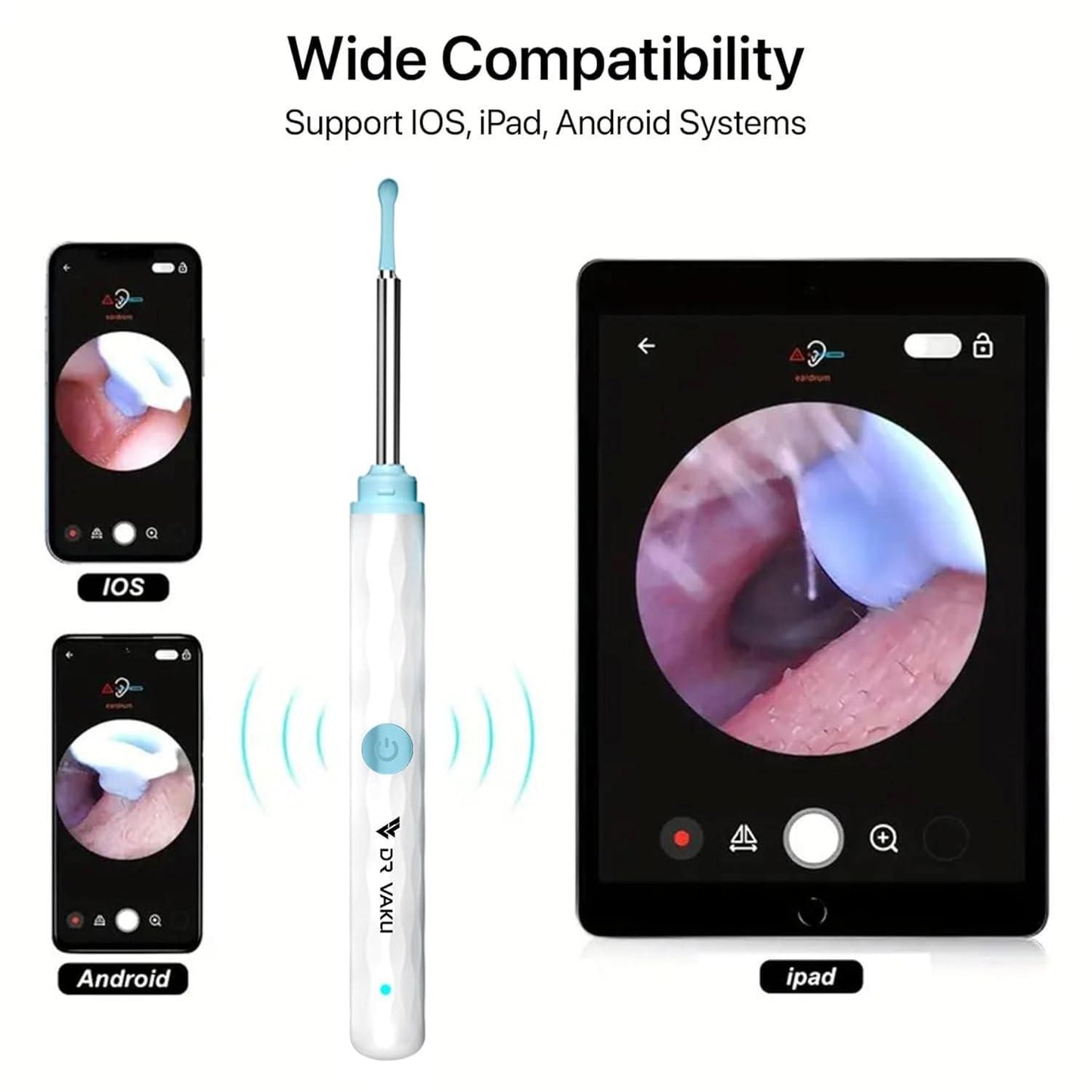 Smart Visual Ear Wax Cleaner with HD Camera & LED Light