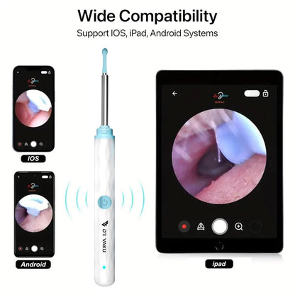 Smart Visual Ear Wax Cleaner with HD Camera & LED Light