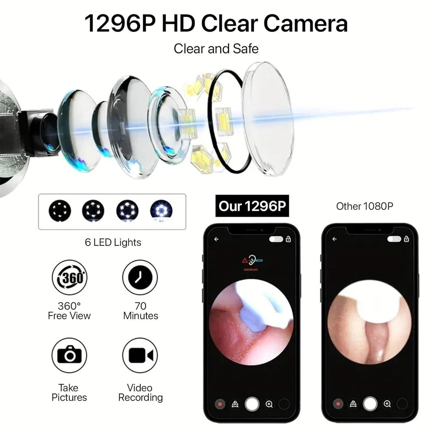 Smart Visual Ear Wax Cleaner with HD Camera & LED Light